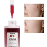 Special Fruit Acid Salicylic Acid essence Exfoliating&Shrinking Pore Moisturizing essence of TItok Hot Beauty Salon