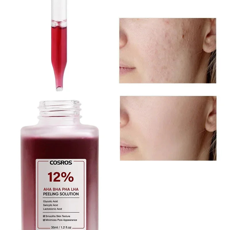 Special Fruit Acid Salicylic Acid essence Exfoliating&Shrinking Pore Moisturizing essence of TItok Hot Beauty Salon